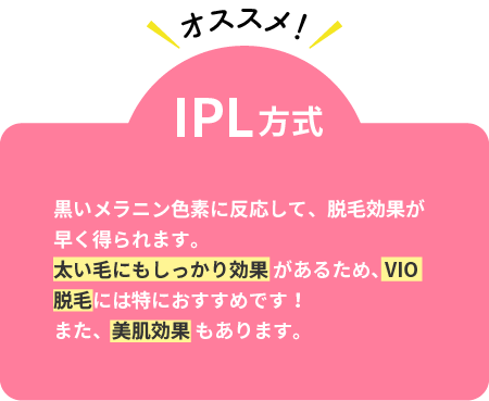 IPL方式